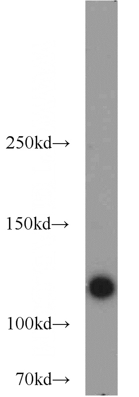 HeLa cells were subjected to SDS PAGE followed by western blot with Catalog No:109089(TSPYL2,TSPX,NP79 antibody) at dilution of 1:1000