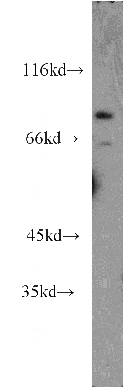HepG2 cells were subjected to SDS PAGE followed by western blot with Catalog No:110948(GFM2 antibody) at dilution of 1:1000