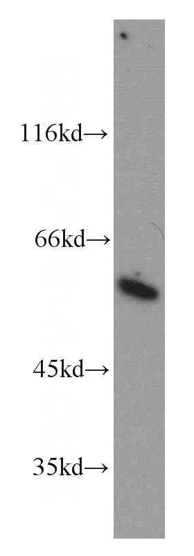 HeLa cells were subjected to SDS PAGE followed by western blot with Catalog No:109598(GPS1 antibody) at dilution of 1:500