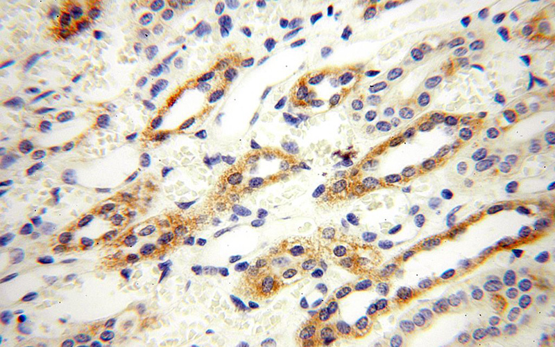 Immunohistochemical of paraffin-embedded human kidney using Catalog No:110960(GGPS1 antibody) at dilution of 1:100 (under 40x lens)