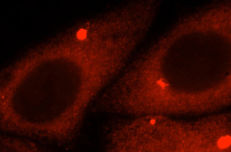 Immunofluorescent analysis of HepG2 cells, using AMFR antibody Catalog No:107990 at 1:25 dilution and Rhodamine-labeled goat anti-rabbit IgG (red).