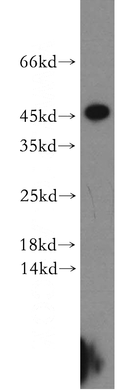 COLO 320 cells were subjected to SDS PAGE followed by western blot with Catalog No:108965(CCDC153 antibody) at dilution of 1:300
