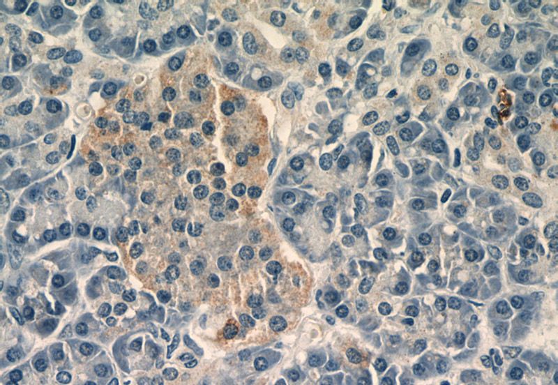 Immunohistochemistry of paraffin-embedded human pancreas tissue slide using Catalog No:116604(USP3 Antibody) at dilution of 1:50 (under 40x lens)