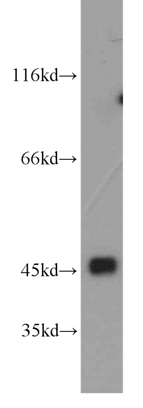 human brain tissue were subjected to SDS PAGE followed by western blot with Catalog No:109789(CYTH3 antibody) at dilution of 1:800