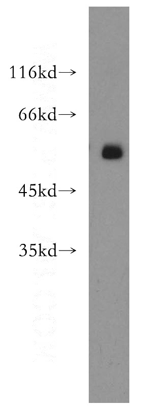 K-562 cells were subjected to SDS PAGE followed by western blot with Catalog No:109819(DDX19B antibody) at dilution of 1:500