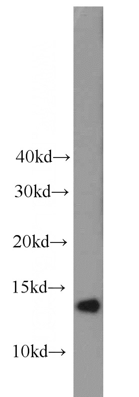 COLO 320 cells were subjected to SDS PAGE followed by western blot with Catalog No:110802(GABARAPL2-Specific antibody) at dilution of 1:800