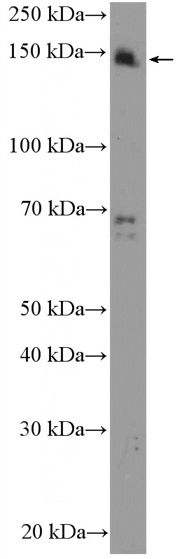 HeLa cells were subjected to SDS PAGE followed by western blot with Catalog No:115741(SUPT5H Antibody) at dilution of 1:600