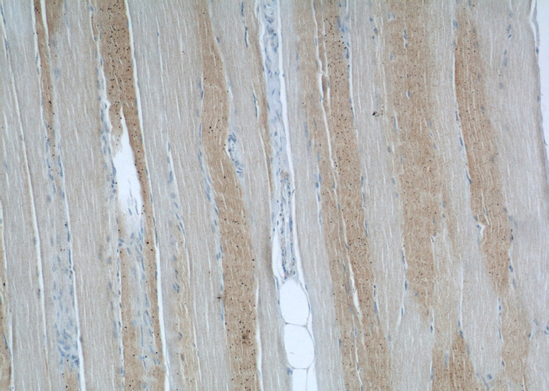 Immunohistochemical of paraffin-embedded human skeletal muscle using Catalog No:107815(ABHD5 antibody) at dilution of 1:50 (under 10x lens)