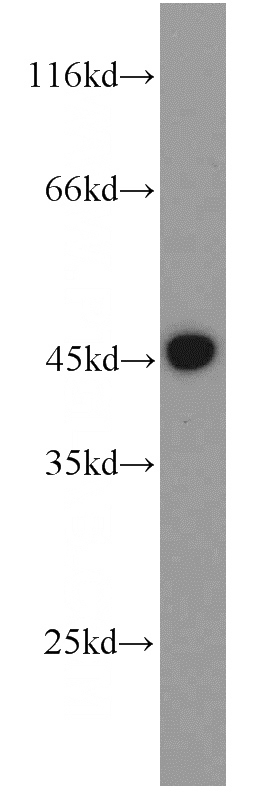 HEK-293 cells were subjected to SDS PAGE followed by western blot with Catalog No:111316(GULP1 antibody) at dilution of 1:1500