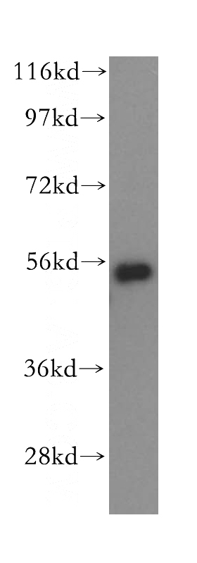 HepG2 cells were subjected to SDS PAGE followed by western blot with Catalog No:111374(HDAC2-specific antibody) at dilution of 1:500