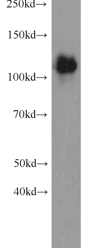 A549 cells were subjected to SDS PAGE followed by western blot with Catalog No:110243(EML4 antibody) at dilution of 1:2000