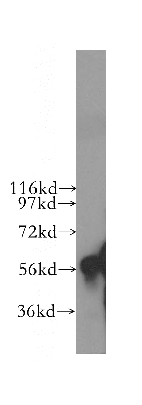human liver tissue were subjected to SDS PAGE followed by western blot with Catalog No:109705(CYP4F11 antibody) at dilution of 1:500