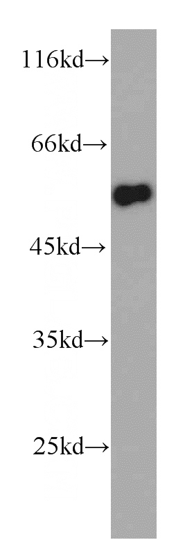 HEK-293 cells were subjected to SDS PAGE followed by western blot with Catalog No:116297(TRIM11 antibody) at dilution of 1:100