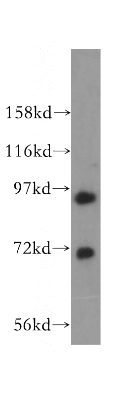 NIH/3T3 cells were subjected to SDS PAGE followed by western blot with Catalog No:112558(MCM8 antibody) at dilution of 1:300