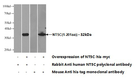 Transfected HEK-293 cells were subjected to SDS PAGE followed by western blot with Catalog No:113391(NT5C Antibody) at dilution of 1:700