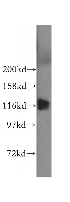 HL-60 cells were subjected to SDS PAGE followed by western blot with Catalog No:116513(UBE1 antibody) at dilution of 1:500