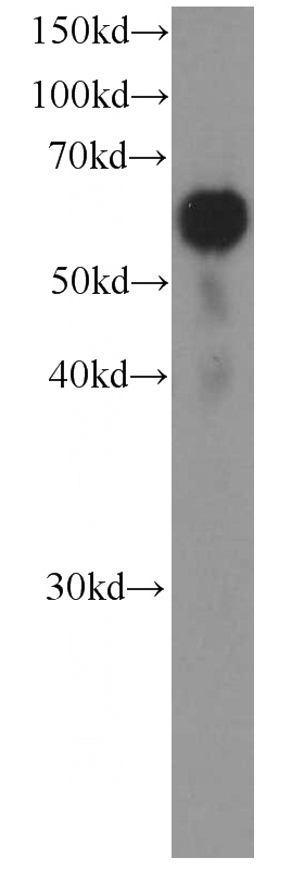 Jurkat cells were subjected to SDS PAGE followed by western blot with Catalog No:107372(LBP Antibody) at dilution of 1:1000