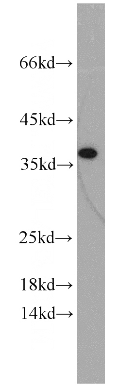 A2780 cells were subjected to SDS PAGE followed by western blot with Catalog No:111686(IGFBP3 antibody) at dilution of 1:100