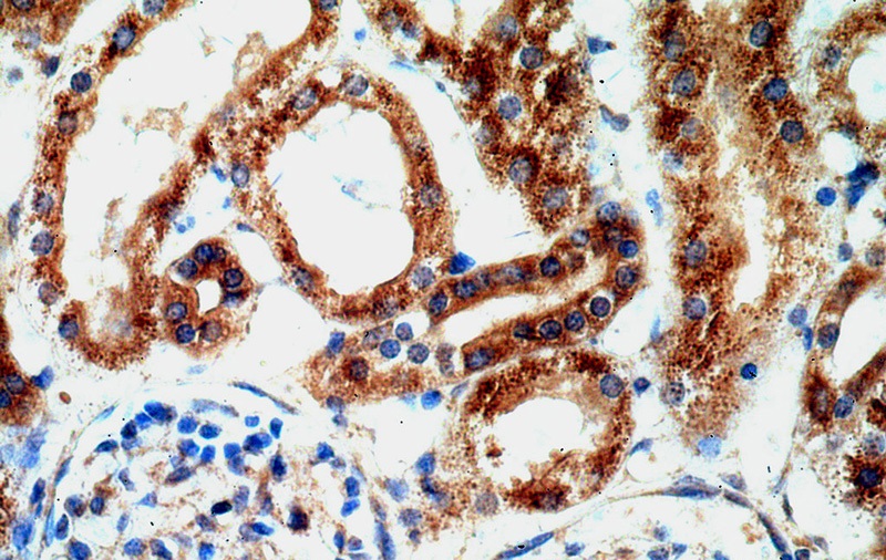 Immunohistochemical of paraffin-embedded human kidney using Catalog No:116282(TMX2 antibody) at dilution of 1:200 (under 40x lens)