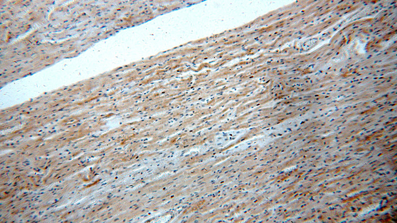 Immunohistochemical of paraffin-embedded human heart using Catalog No:110924(MSTN antibody) at dilution of 1:50 (under 10x lens)