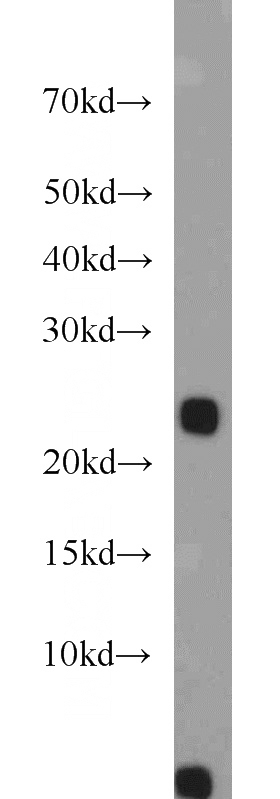 mouse skeletal muscle tissue were subjected to SDS PAGE followed by western blot with Catalog No:113923(PLA2G12A antibody) at dilution of 1:1000