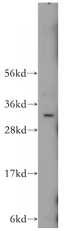 human brain tissue were subjected to SDS PAGE followed by western blot with Catalog No:113341(OLIG2 antibody) at dilution of 1:400