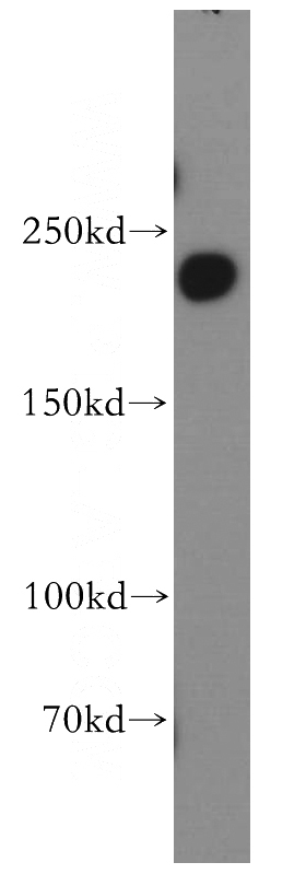 human brain tissue were subjected to SDS PAGE followed by western blot with Catalog No:110046(DocK7 antibody) at dilution of 1:300