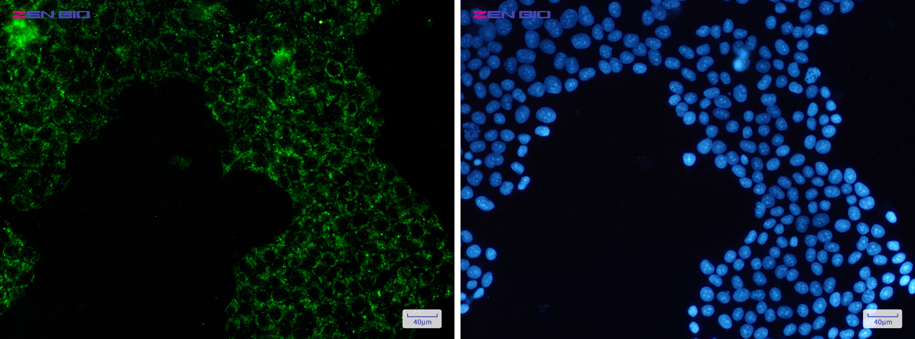 Immunocytochemistry of Pyruvate Dehydrogenase E1-alpha subunit(green) in Hela cells using Pyruvate Dehydrogenase E1-alpha subunit Rabbit pAb at dilution 1/50, and DAPI(blue)