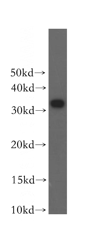 human brain tissue were subjected to SDS PAGE followed by western blot with Catalog No:114532(RALYL antibody) at dilution of 1:800