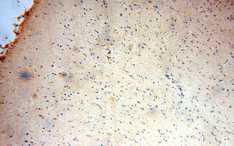 Immunohistochemical of paraffin-embedded human brain using Catalog No:113669(PDE7B antibody) at dilution of 1:100 (under 10x lens)