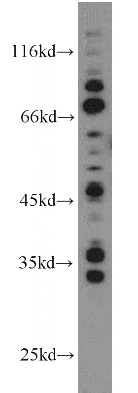 MCF7 cells were subjected to SDS PAGE followed by western blot with Catalog No:108005(AREG antibody) at dilution of 1:2000