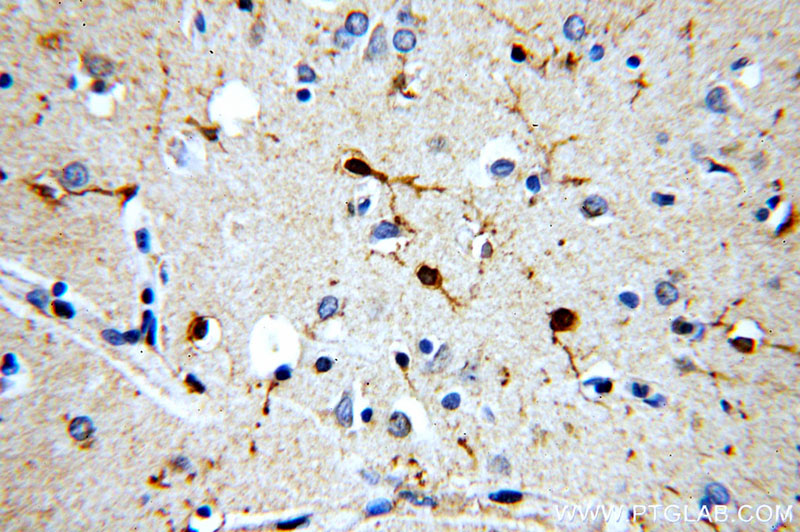Immunohistochemical of paraffin-embedded human brain using Catalog No:108919(CAMK2D-Specific antibody) at dilution of 1:100 (under 40x lens)
