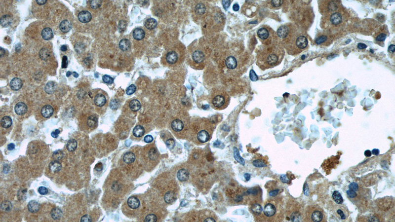 Immunohistochemical of paraffin-embedded human liver using Catalog No:112456(MAGT1 antibody) at dilution of 1:50 (under 40x lens)