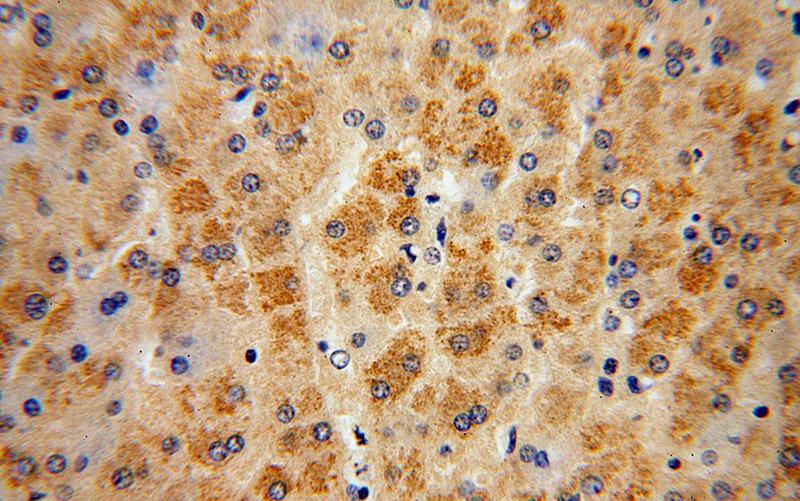 Immunohistochemical of paraffin-embedded human liver using Catalog No:115794(STX17 antibody) at dilution of 1:50 (under 40x lens)