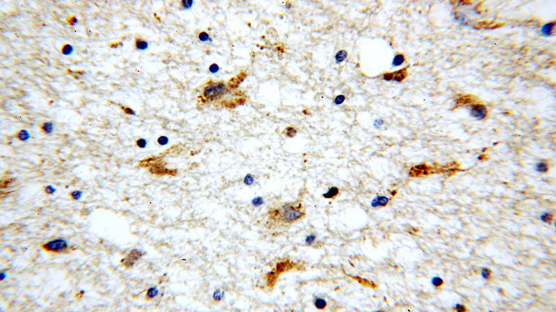 Immunohistochemical of paraffin-embedded human brain using Catalog No:109733(C1QTNF4 antibody) at dilution of 1:100 (under 40x lens)