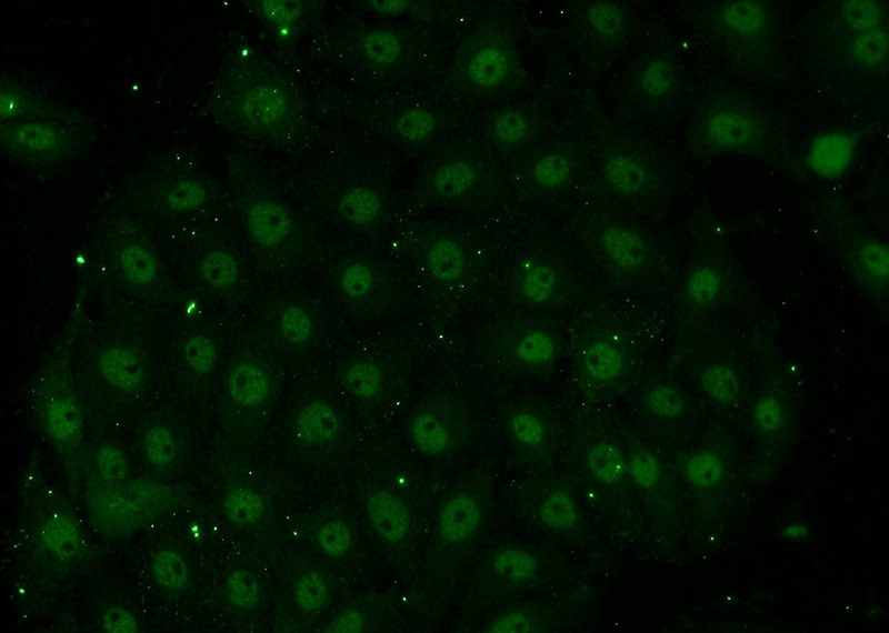 Immunofluorescent analysis of SH-SY5Y cells using Catalog No:110161(EAF1 Antibody) at dilution of 1:50 and Alexa Fluor 488-congugated AffiniPure Goat Anti-Rabbit IgG(H+L)