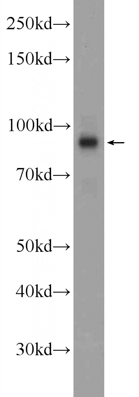 HEK-293 cells were subjected to SDS PAGE followed by western blot with Catalog No:111392(HEATR2 Antibody) at dilution of 1:600