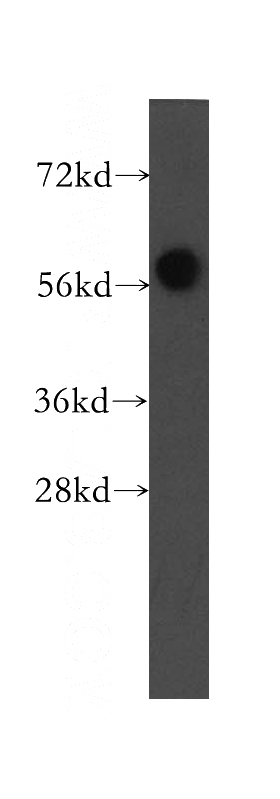HeLa cells were subjected to SDS PAGE followed by western blot with Catalog No:112790(MTMR8 antibody) at dilution of 1:300