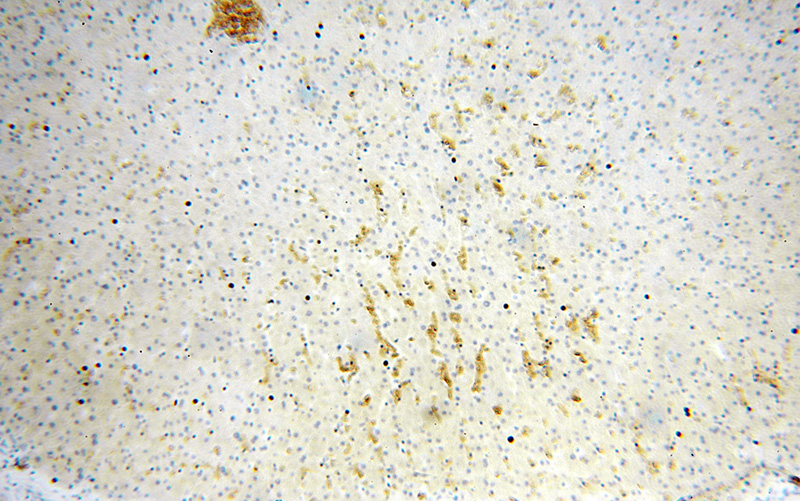 Immunohistochemical of paraffin-embedded human liver using Catalog No:111276(HBZ antibody) at dilution of 1:100 (under 10x lens)