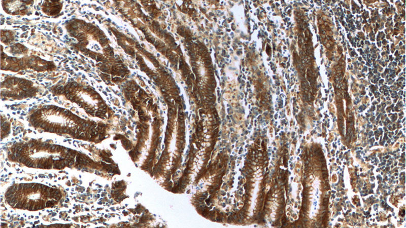 Immunohistochemistry of paraffin-embedded human stomach tissue slide using Catalog No:107576(CTNNA1 Antibody) at dilution of 1:200 (under 10x lens)