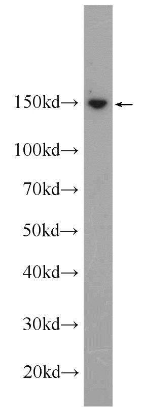 MCF-7 cells were subjected to SDS PAGE followed by western blot with Catalog No:115043(SAFB Antibody) at dilution of 1:1000