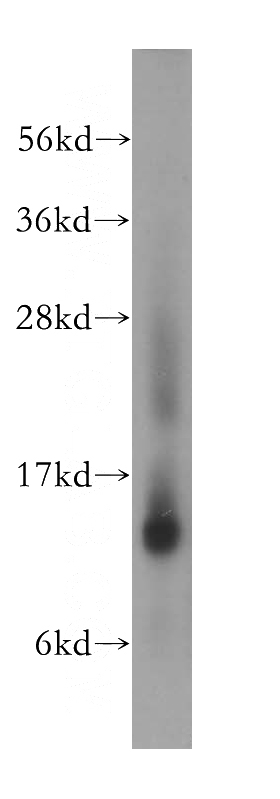 K-562 cells were subjected to SDS PAGE followed by western blot with Catalog No:113398(NUTF2 antibody) at dilution of 1:500