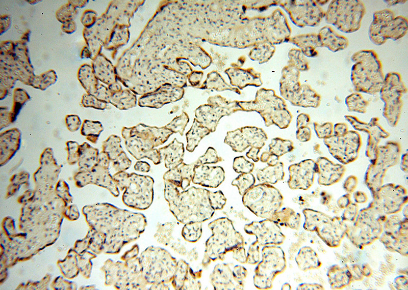 Immunohistochemical of paraffin-embedded human placenta using Catalog No:116140(TIMP2 antibody) at dilution of 1:50 (under 10x lens)