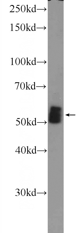 mouse heart tissue were subjected to SDS PAGE followed by western blot with Catalog No:108011(PRKAG2 Antibody) at dilution of 1:600