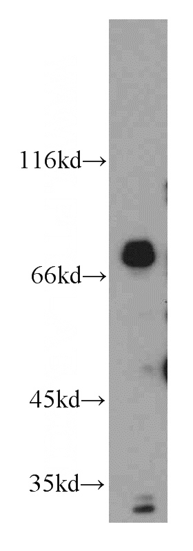 K-562 cells were subjected to SDS PAGE followed by western blot with Catalog No:110108(MPP11 antibody) at dilution of 1:300