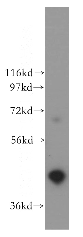 K-562 cells were subjected to SDS PAGE followed by western blot with Catalog No:110161(EAF1 antibody) at dilution of 1:500