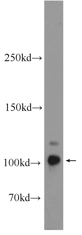 PC-3 cells were subjected to SDS PAGE followed by western blot with Catalog No:112611(MICALL2 Antibody) at dilution of 1:1000