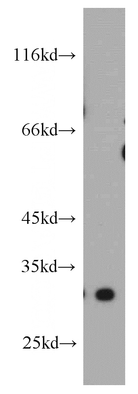 human placenta tissue were subjected to SDS PAGE followed by western blot with Catalog No:109982(DKK1 antibody) at dilution of 1:500