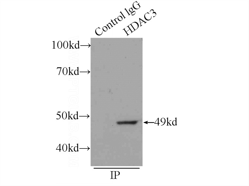 IP Result of anti-HDAC3 (IP:Catalog No:111375, 3ug; Detection:Catalog No:111375 1:300) with A431 cells lysate 1200ug.