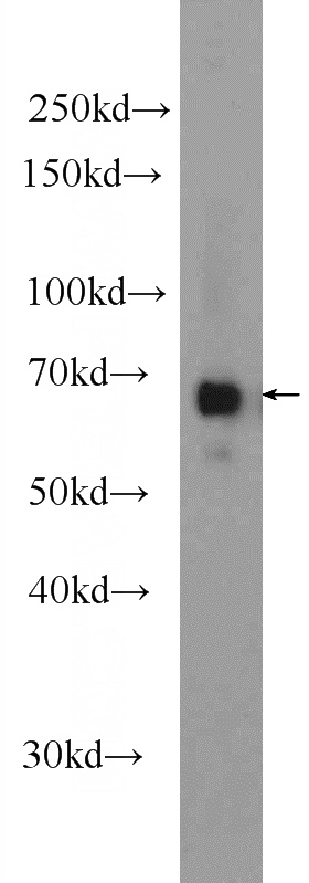 mouse heart tissue were subjected to SDS PAGE followed by western blot with Catalog No:115779(SYNC Antibody) at dilution of 1:600